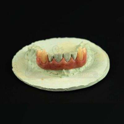 BRAM STOKER'S DRACULA (1992) - Dracula (Gary Oldman) Fangs on Teeth Cast