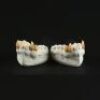 THE LOST BOYS (1987) - Max (Edward Herrmann) Fangs on Teeth Casts