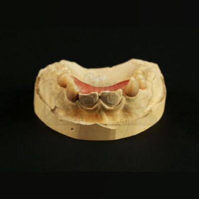 THE LOST BOYS (1987) - Laddie (Chance Michael Corbitt) Fangs on Teeth Cast
