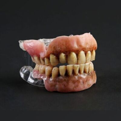 SEASON 1 EPISODE 2: "AMUSE-BOUCHE"<br> Mushroom Guy SFX Veneers