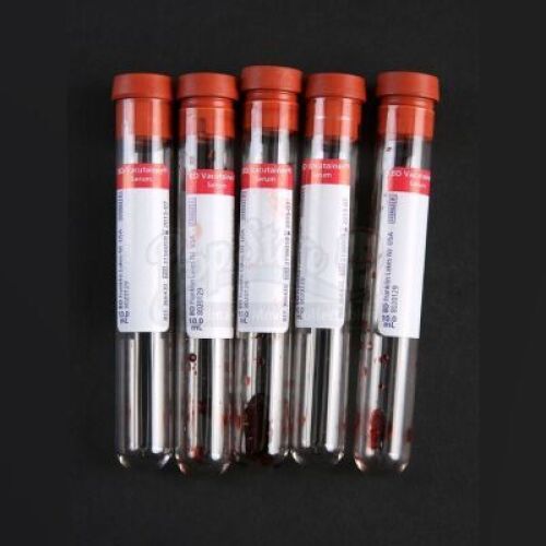 SEASON 1 EPISODE 7: "SORBET"<br>CSI Lab Blood Vials