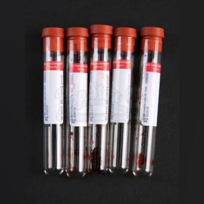 SEASON 1 EPISODE 7: "SORBET"<br>CSI Lab Blood Vials