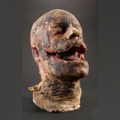 SEASON 2 EPISODE 3: "HASSUN"<br>Andrew Sykes' Charred Head