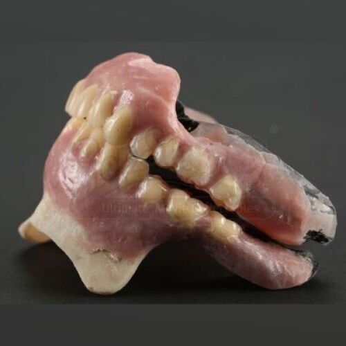 SEASON 2 EPISODE 12: "TOME-WAN"<br>Mason Verger's (Michael Pitt) SFX Dental Veneers