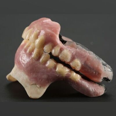 SEASON 2 EPISODE 12: "TOME-WAN"<br>Mason Verger's (Michael Pitt) SFX Dental Veneers