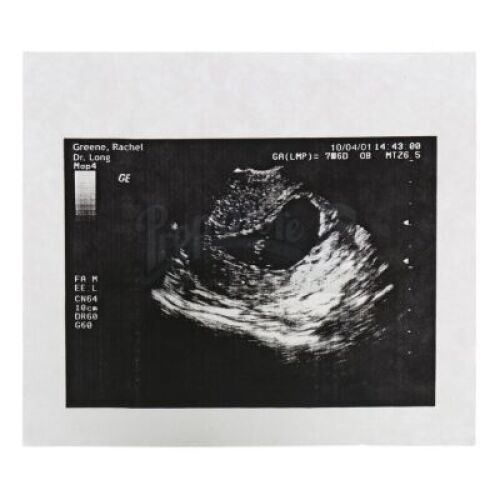 Lot # 52: FRIENDS - Rachel Green's Sonogram of Baby Emma