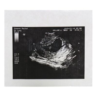 Lot # 52: FRIENDS - Rachel Green's Sonogram of Baby Emma