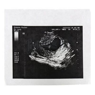 Lot # 65: FRIENDS - Rachel Green's Sonogram of Baby Emma