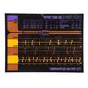 Lot # 1065: STAR TREK: THE NEXT GENERATION (T.V. SERIES, 1987 - 1994) - Medical LCARS Panel of Jean-Luc Picard's (Patrick Stewart) Heart Rate
