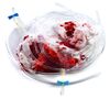 Lot # 14: The Gifted - Glow's Blood Transfusion Accessories - 4