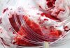 Lot # 14: The Gifted - Glow's Blood Transfusion Accessories - 5