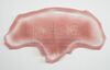 Lot # 100: The Gifted - Dr. Roderick Campbell's Scar Appliances with Four Mutant Prosthetics - 3