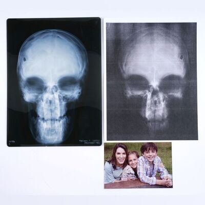 Lot #382: MARVEL - VARIOUS PRODUCTIONS (T.V. SERIES, 2015 - 2019) - Pair of Frank Castle's Skull X-Ray Images and Photo of the Castle Family