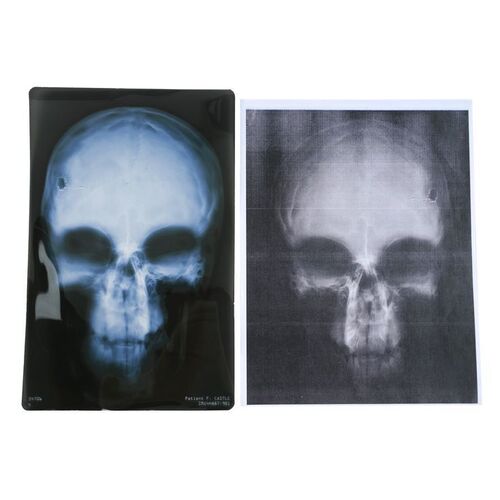 Lot #460: MARVEL'S DAREDEVIL (T.V. SERIES, 2015 - 2018) - Frank Castle's Skull X-Ray and Photocopy of X-Ray
