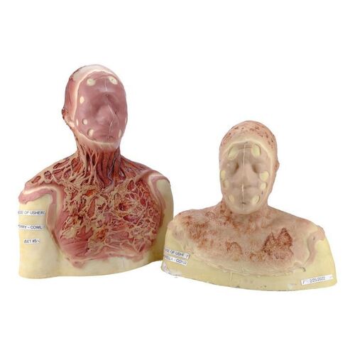Lot # 52: The Fall of the House of Usher - Morelle 'Morrie' Usher's (Crystal Balint) and Prospero 'Perry' Usher's (Sauriyan Sapkota) Burnt Face Cowl and Hands
