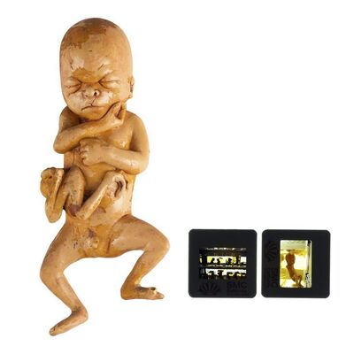 1914. Alien Clone Fetus ### THE X-FILES (1993 - 2002)