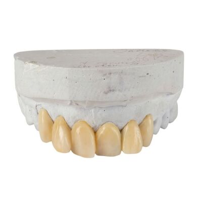 196. Jean-Baptiste Emanuel Zorg's (Gary Oldman) Teeth Appliance on Dental Cast ### FIFTH ELEMENT, THE (1997)