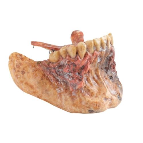 650. Evil Ash's (Bruce Campbell) Lower Jaw Appliance ### ARMY OF DARKNESS (1992)